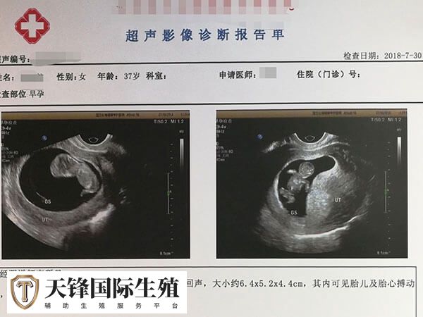 les赴美做试管生育是怎样的过程